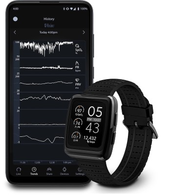 Masimo W1 Watch & Phone Display